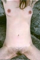 ATK hairy  in mature and hairy