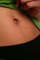 ATK hairy  in mature and hairy