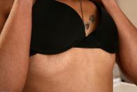 ATK hairy  in mature and hairy