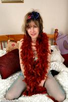 ATK hairy  in mature and hairy