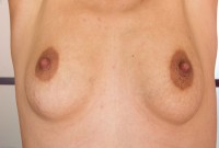 ATK hairy Loredana Set