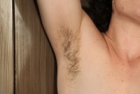 ATK hairy  in young and hairy