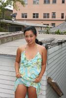 ATK hairy  in mature and hairy