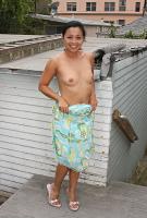 ATK hairy  in mature and hairy