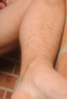 ATK hairy  in mature and hairy