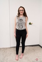 ATK hairy  in young and hairy