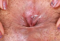 ATK hairy  in exotic and hairy