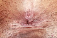 ATK hairy  in exotic and hairy