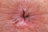 ATK hairy Lulu Sparkle Set