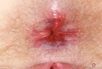 ATK hairy Lux Lives Set