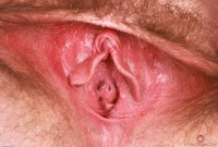 ATK hairy Lux Lives Set