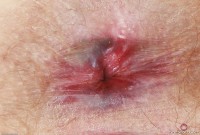 ATK hairy Lux Lives Set