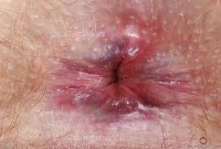 ATK hairy Lux Lives in mature and hairy