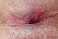 ATK hairy Lux Lives in mature and hairy