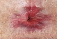 ATK hairy Lux Lives in mature and hairy