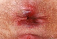 ATK hairy Lux Lives in mature and hairy