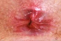 ATK hairy Lux Lives Set