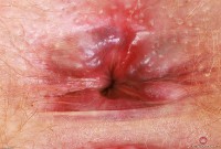 ATK hairy Lux Lives Set