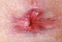 ATK hairy Lux Lives Set