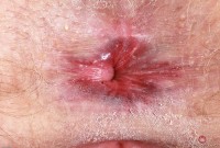 ATK hairy Lux Lives Set