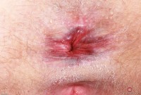 ATK hairy Lux Lives in mature and hairy