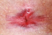 ATK hairy Lux Lives Set