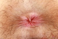 ATK hairy  in young and hairy