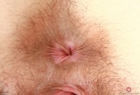 ATK hairy  in young and hairy