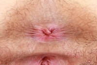 ATK hairy  in young and hairy