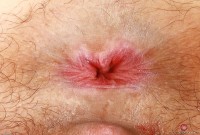 ATK hairy  in young and hairy