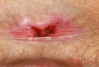 ATK hairy Lyra Lockhart Set