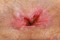 ATK hairy Lyra Lockhart Set