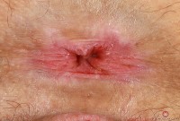 ATK hairy Lyra Lockhart Set