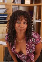 ATK hairy  in mature and hairy