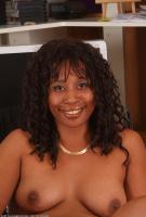 ATK hairy  in mature and hairy