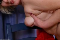 ATK hairy  in mature and hairy