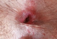 ATK hairy Manila Bey Set