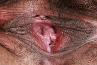 ATK hairy Manila Bey Set