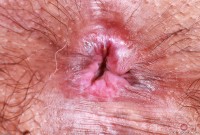 ATK hairy Manila Bey Set