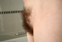 ATK hairy  in mature and hairy