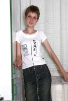 ATK hairy  in young and hairy