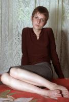 ATK hairy  in young and hairy