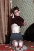 ATK hairy  in young and hairy