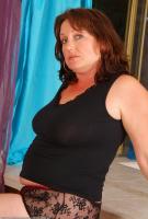 ATK hairy  in mature and hairy