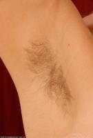 ATK hairy  in young and hairy