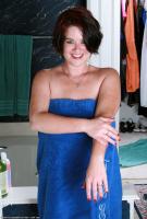 ATK hairy  in mature and hairy