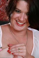 ATK hairy  in mature and hairy