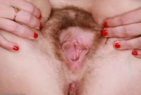 ATK hairy  in mature and hairy