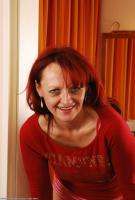 ATK hairy  in mature and hairy