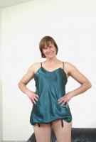 ATK hairy  in mature and hairy